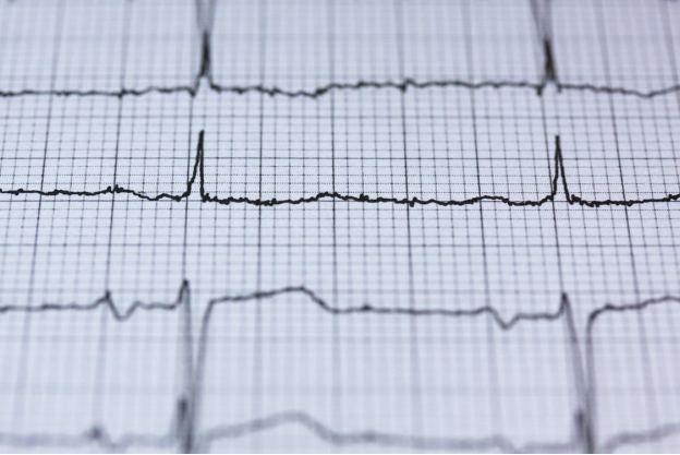 Using a Defibrillator—an Expert Guide to Saving a Life