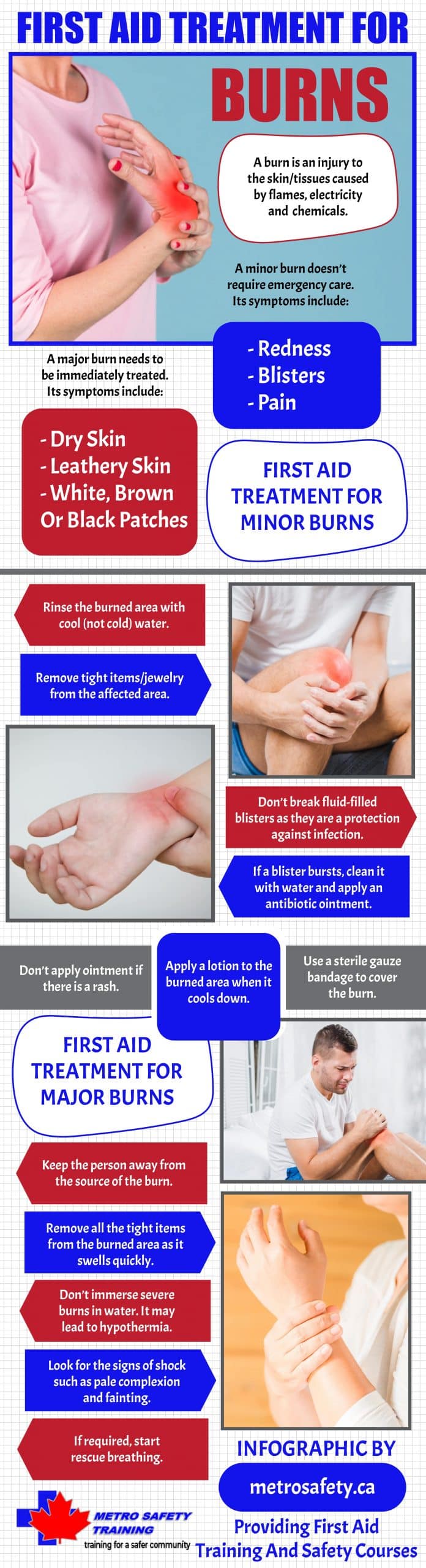 First Aid for Burns – how to reduce pain and scarring - Online First Aid