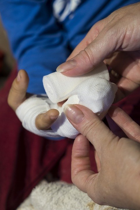 Burn victim with a bandage on hands