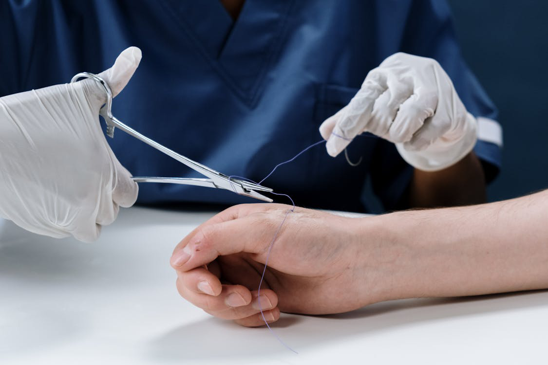 A medical professional giving stitches to a person’s hand